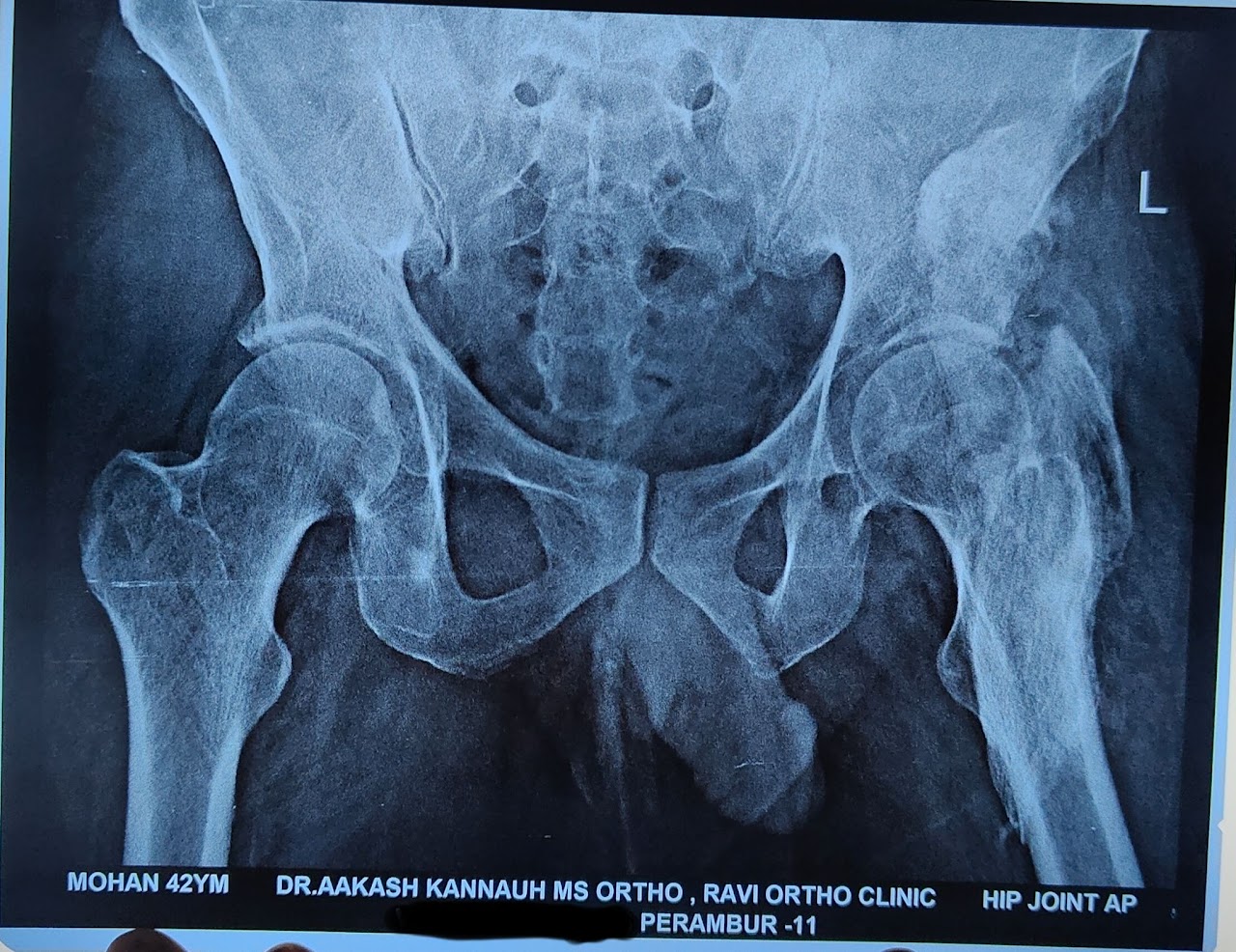 X-ray image 3