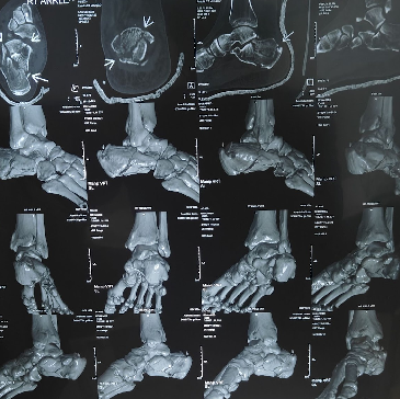 Non-surgical orthopaedic treatment